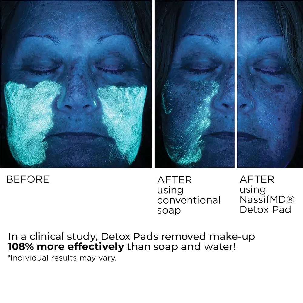 ✨ NassifMD Dermaceuticals Detox Pads – Complexion Perfecting Pads (30 Count) ✨